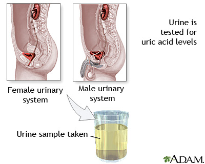 Uric acid test Uric acid test