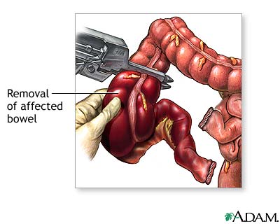 Procedure, part 1