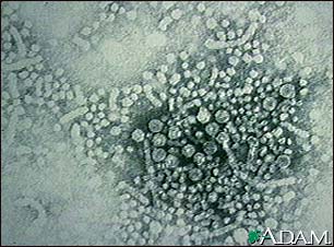 Hepatitis B virus Hepatitis B virus