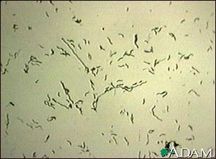 Campylobacter jejuni organism Campylobacter jejuni organism