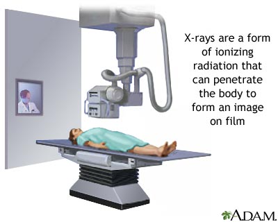 X-ray X-ray