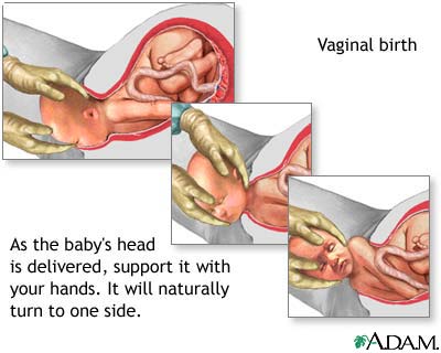 Childbirth Childbirth