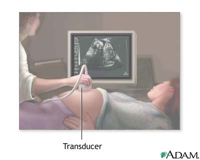 Ultrasound in pregnancy Ultrasound in pregnancy