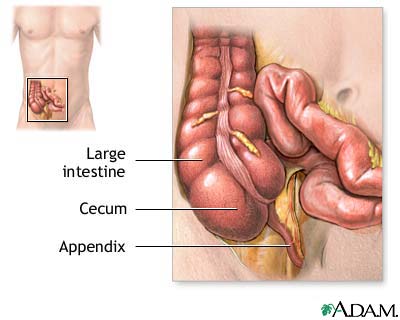 Appendix Appendix