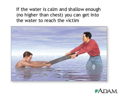 Drowning rescue, board assist Drowning rescue, board assist