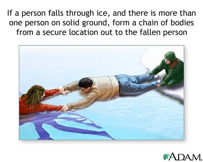 Drowning rescue on the ice, human chain Drowning rescue on the ice, human chain
