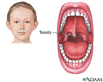 Normal anatomy