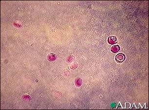 Cryptosporidium, organism Cryptosporidium, organism