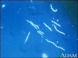 Lyme disease - Borrelia burgdorferi organism Lyme disease - Borrelia burgdorferi organism