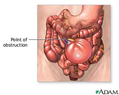 Indication, part 1