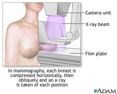Mammogram Mammogram
