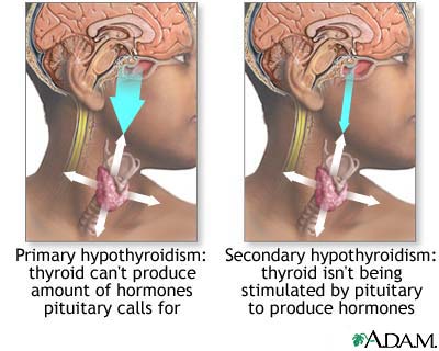 Primary and secondary hypothyroidism Primary and secondary hypothyroidism
