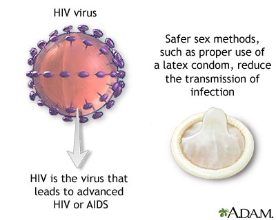 HIV HIV