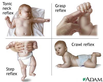Infantile reflexes Infantile reflexes