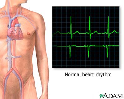 Normal heart rhythm