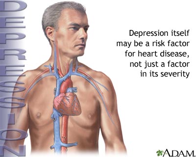 Depression and heart disease