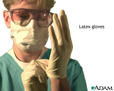 Latex allergy Latex allergy