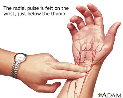 Radial pulse Radial pulse