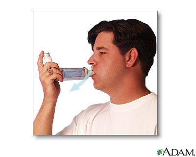 Spacer use - part five