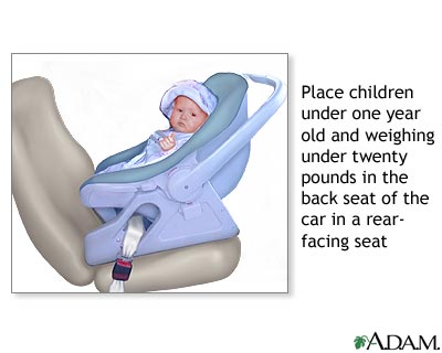 Rear-facing car seat Rear-facing car seat