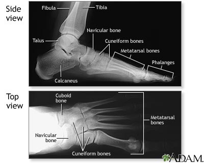 Normal foot X-ray Normal foot X-ray