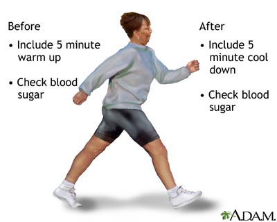 Diabetes and exercise Diabetes and exercise