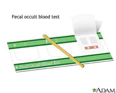 Fecal occult blood test Fecal occult blood test