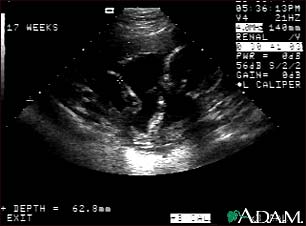 Ultrasound, normal fetus - arm and legs Ultrasound, normal fetus - arm and legs