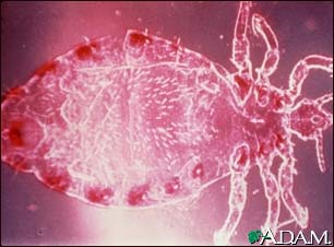 Head louse, male Head louse, male