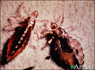 Lice, body with stool (Pediculus humanus) Lice, body with stool (Pediculus humanus)