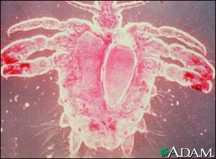 Crab louse, female Crab louse, female