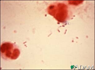 Haemophilus influenza organism Haemophilus influenza organism