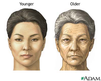 Changes in face with age