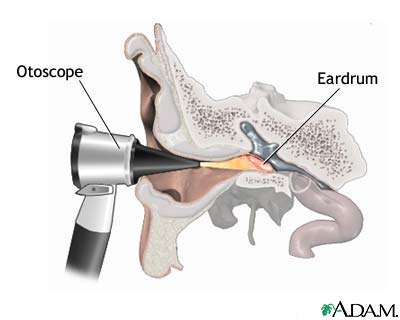 Otoscopic exam of the ear Otoscopic exam of the ear