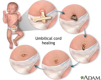 Umbilical care Umbilical care