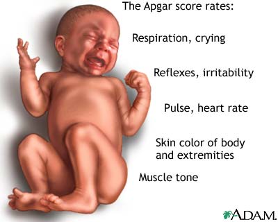 Newborn test Newborn test