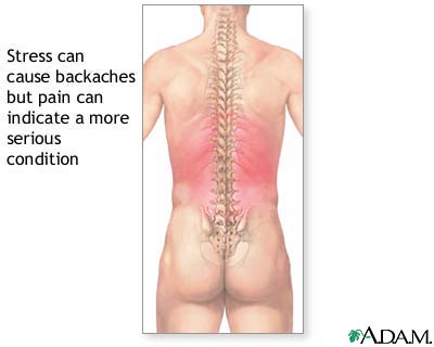 Backaches