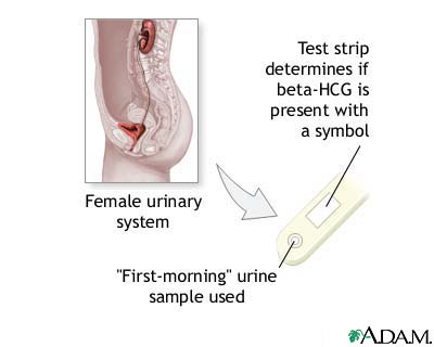 Pregnancy test