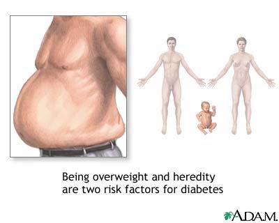 Diabetes risk factors Diabetes risk factors