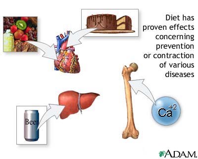 Diet and disease prevention Diet and disease prevention