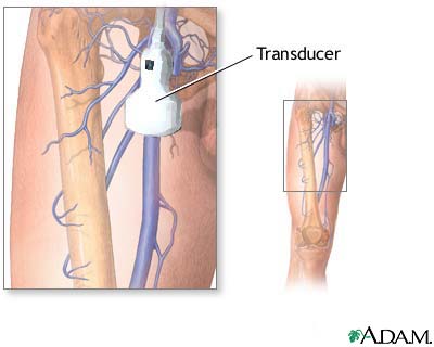 Doppler ultrasonography of an extremity Doppler ultrasonography of an extremity