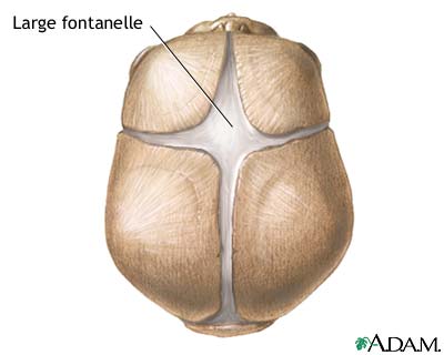 Large fontanelles Large fontanelles