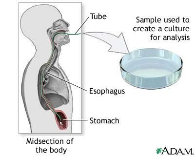 Culture of gastric tissue biopsy Culture of gastric tissue biopsy
