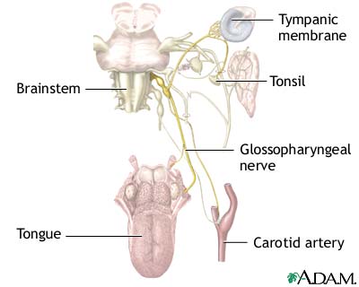 Glossopharyngeal neuralgia Glossopharyngeal neuralgia