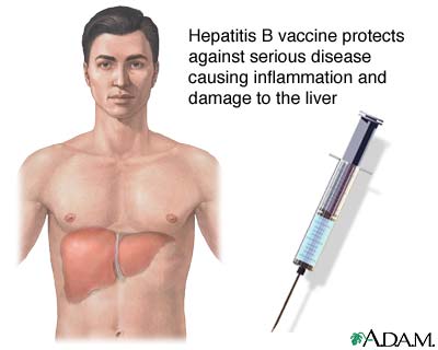 Hepatitis B Hepatitis B