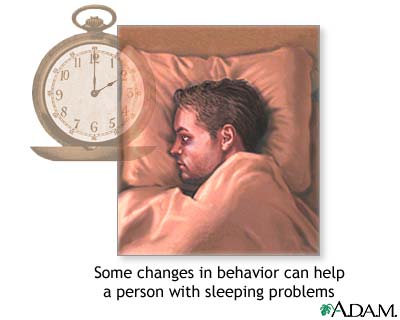 Insomnia concerns Insomnia concerns