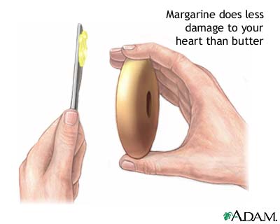 Margarine vs butter Margarine vs butter
