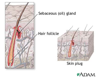 Hair follicle anatomy Hair follicle anatomy