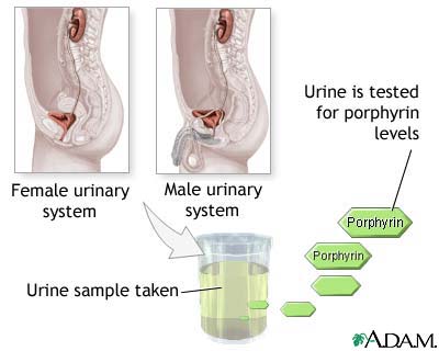 Porphyrin urine test Porphyrin urine test