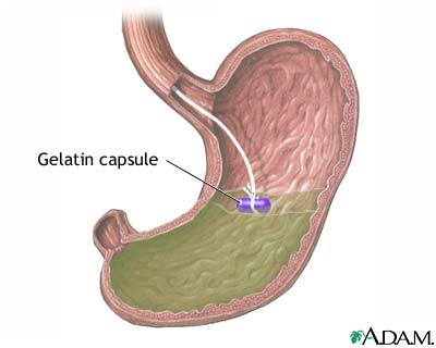 Gelatin capsule in stomach Gelatin capsule in stomach